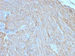 CD117/c-kit Antibody (C117/370), Novus Biologicals:Antibodies:Primary Antibodies